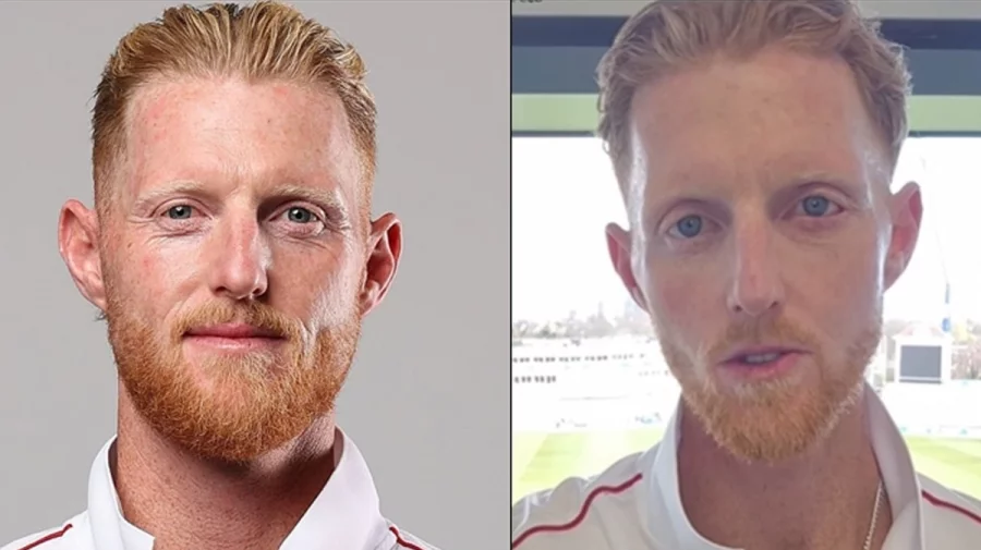 ভয়াবহ ইনজুরির পর বদলে গেছে বেন স্টোকসের চেহারা